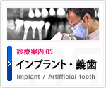 インプラント・義歯 Implant / Artifficial tooth